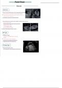 15. fetal chest (obgyn ultrasound)
