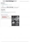 2. liver pathology (abdominal ultrasound)