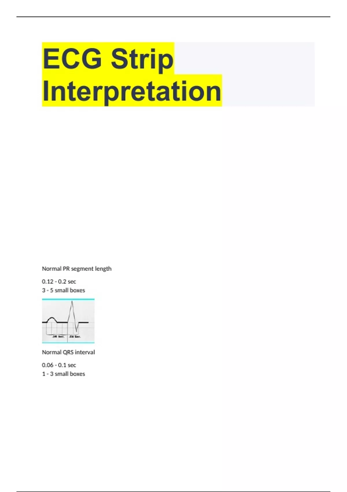 ECG Strip Interpretation with correct answers 100 ECG Stuvia UK