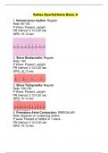 Relias Dysrhythmia Basic A Version 2 &lpar;55 Q&A with Rational and rhythm strips&rpar;&colon; 2023-24 &lpar;Best exam preparation document&rpar;