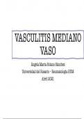 Vasculitis de Mediano Vaso