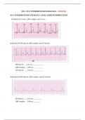 ECG INTERPRETATION EXERCISES -QUESTIONS AND ANSWERS 2023