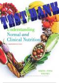 Understanding Normal and Clinical Nutrition 11th Edition by Sharon Rady Rolfes, Kathryn Pinna and Ellie Whitney Test Bank
