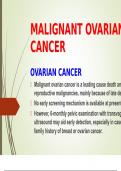 Malignant Ovarian Tumors