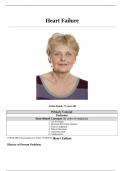 Health CareCase Study Heart Failure, JoAnn Smith, 72 Years Old (Updated JAN 2021).