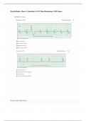 Dysrhythmia - Basic A Question 1 of 35 Time Remaining 34 II Jones Latest Version Score 100&percnt;