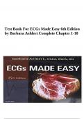 Test Bank For ECGs Made Easy 6th Edition by Barbara Aehlert Complete Chapter 1-10 (VERIFIED) 2023-2024