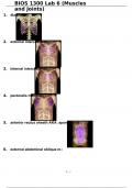 BIOS 1300 Lab 6 &lpar;Muscles and Joints&rpar;