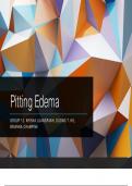 Pitting Edema and Associated Etiologies