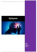 Soorten Epilepsie 