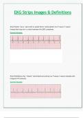 EKG Strips Images & Definitions
