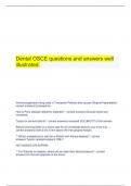 Dental OSCE questions and answers well illustrated.