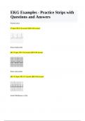 EKG Examples - Practice Strips with Questions and Answers.