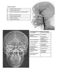 VHT beeldherkenning schedel (Radiologie)
