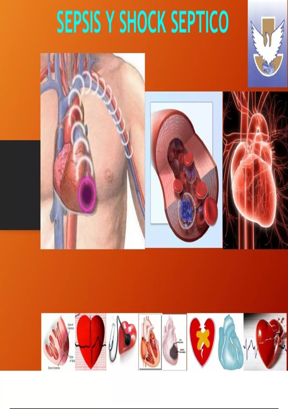 SEPSIS Y SHOCK SÉPTICO - RESÚMENES PARA MEDICINA,MATERIAL PARA ENAM ...