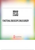 FESS nasal polyposis