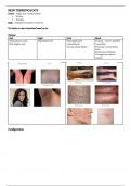 Describing Skin Lesions
