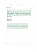 Dysrhythmia - Basic A Question 1 of 35 Time Remaining 34 II Jones Latest Version Score 100%