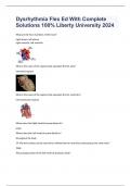 Dysrhythmia Flex Ed With Complete Solutions 100% Liberty University 2024