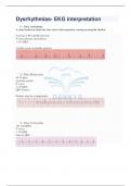 Dysrhythmias- EKG interpretation Questions and Answers Latest 2024 