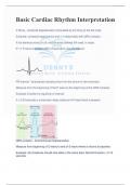 Basic Cardiac Rhythm Interpretation with Complete Solutions 100% Correct, 2024
