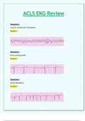 ACLS EKG Review&lowbar;All Correct 100&percnt;