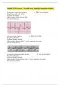 StaRN ECG Course -Ventricular family(Complete Guide)