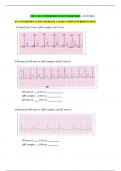 CH 8 - ECG INTERPRETATION EXERCISES - ANSWERS ECG INTERPRETATION EXERCISE 1: BASIC STRIP INTERPRETATION