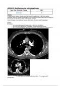 Beeldherkenning pathologie thorax