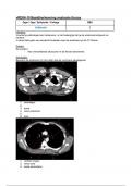 Alle huiswerk/aantekeningen van Radiologie