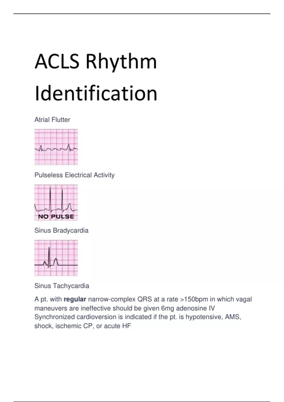 ACLS Rhythm Identification - ACLS - Stuvia US