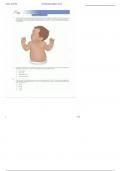 ATI RN Child Health Form B 2024 With 65 Questions and Correct Answers&period;