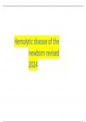 Hemolytic disease of the newborn revised 2024 
