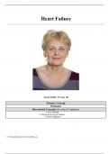 JoAnn Smith, 72 years old Heart Failure Case study latest 2024! RATED A+