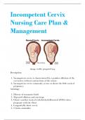 Incompetent Cervix Nursing Care Plan.