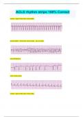 ACLS rhythm strips 100&percnt; Correct