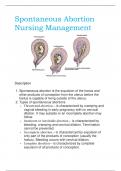 Spontaneous Abortion Nursing Management