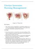 Uterine Inversion Nursing Management.