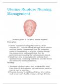 Uterine Rupture Nursing Management