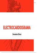 EKG: lectura correcta del un electrocardiograma 