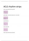 ACLS rhythm strips