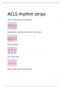 ACLS rhythm strips