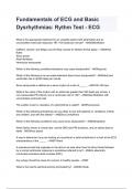 Fundamentals of ECG and Basic Dysrhythmias: Rythm Test - ECG 2024/2025(100% verified) graded A+ by experts