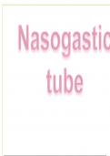 Nasogastric-tube-Insertion  Summary notes