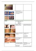 Huidziekten infectie en inflammatie overzicht
