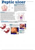 Disease and conditions affecting abdomen
