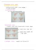 Female Genital Tract Abnormalities USMLE