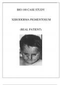 BIO 188 XERODERMA PIGMENTOSUM CASE STUDY REVIEW ( REAL PATIENT