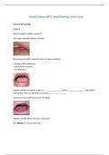 Dental Hygiene OSCE - Oral Pathology 100% exam.
