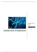 Profielwerkstuk biologie Angelman Syndroom. cijfer: 9,5